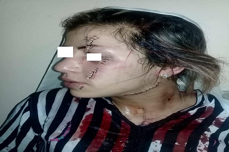 سيدة تشرمل عشيقة زوجها بسطات