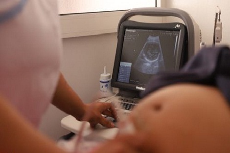 الصندوق الوطني لمنظمات الاحتياط الاجتماعي يشترط الإدلاء بتقرير طبي يعلل اللجوء إلى العملية القيصرية