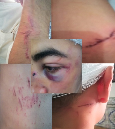 سطات..تعرض شاب للسرقة وللاعتداء شنيع بواسطة الأسلحة البيضاء والجناة في حالة فرار