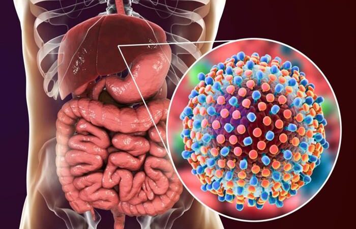 اليوم العالمي لالتهابات الكبد الفيروسية مناسبة للتحسيس وزيادة الوعي بأهمية الوقاية والفحص وعلاج هذا الداء
